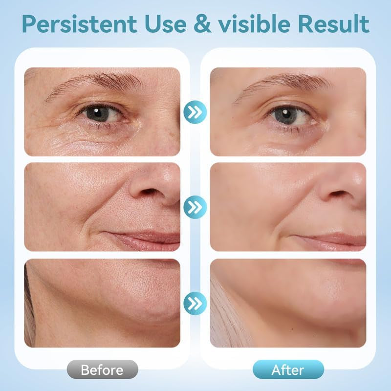 MASAJEADOR FACIAL INFRARROJO